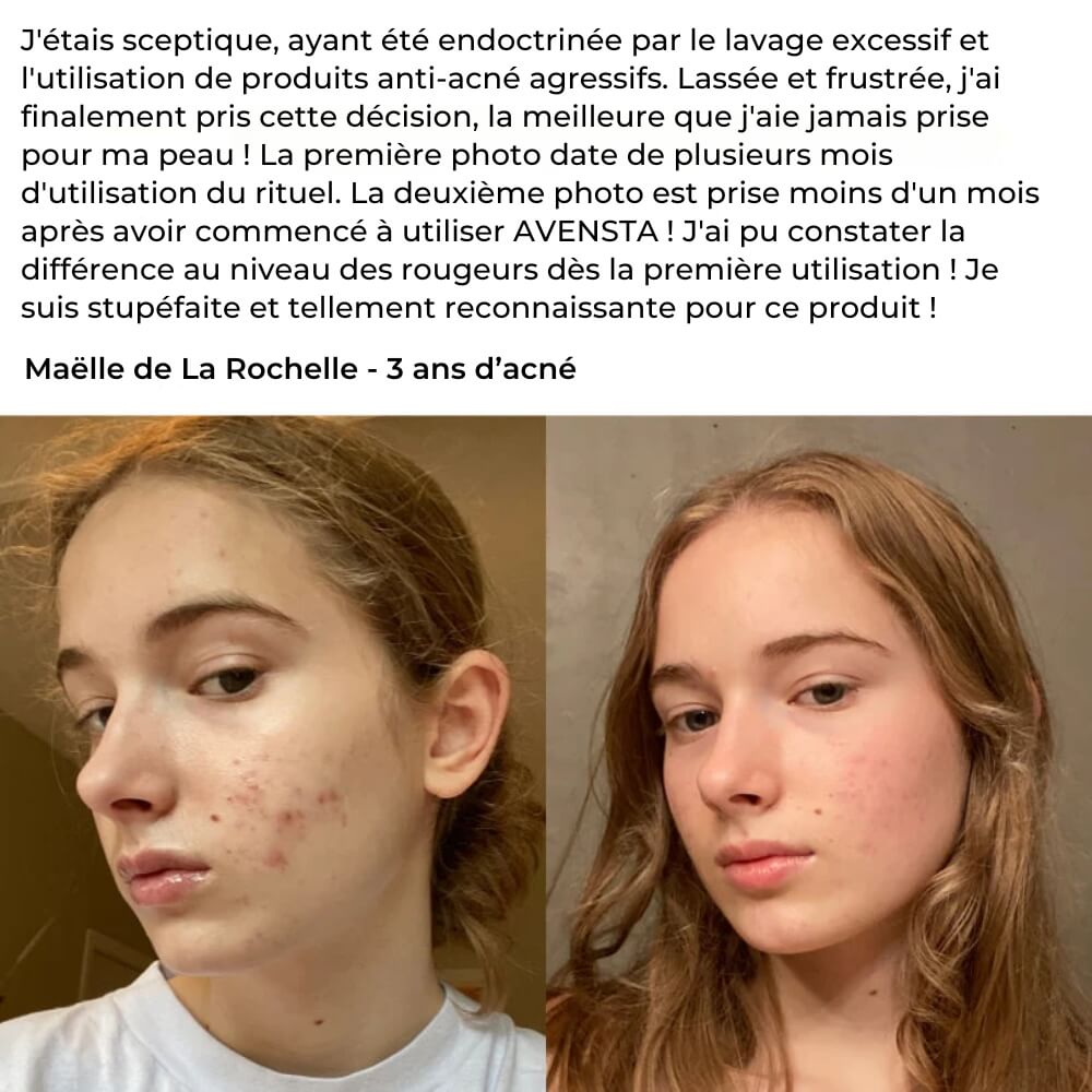 Complete Anti-Acne Ritual - The #1 Natural Solution in France